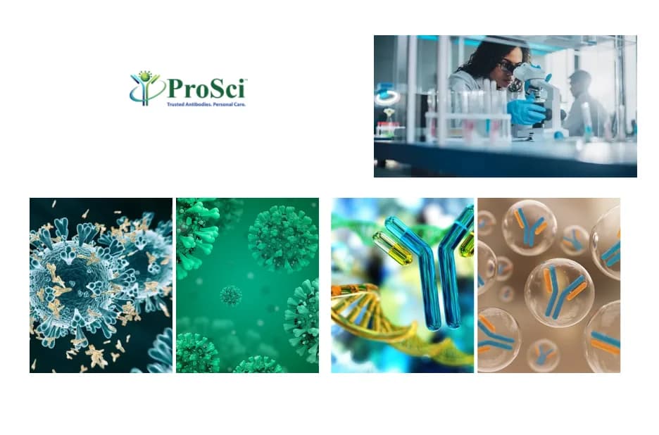 High Quality Primary Antibodies for Research Supporting Accurate and Consistent Scientific Studies