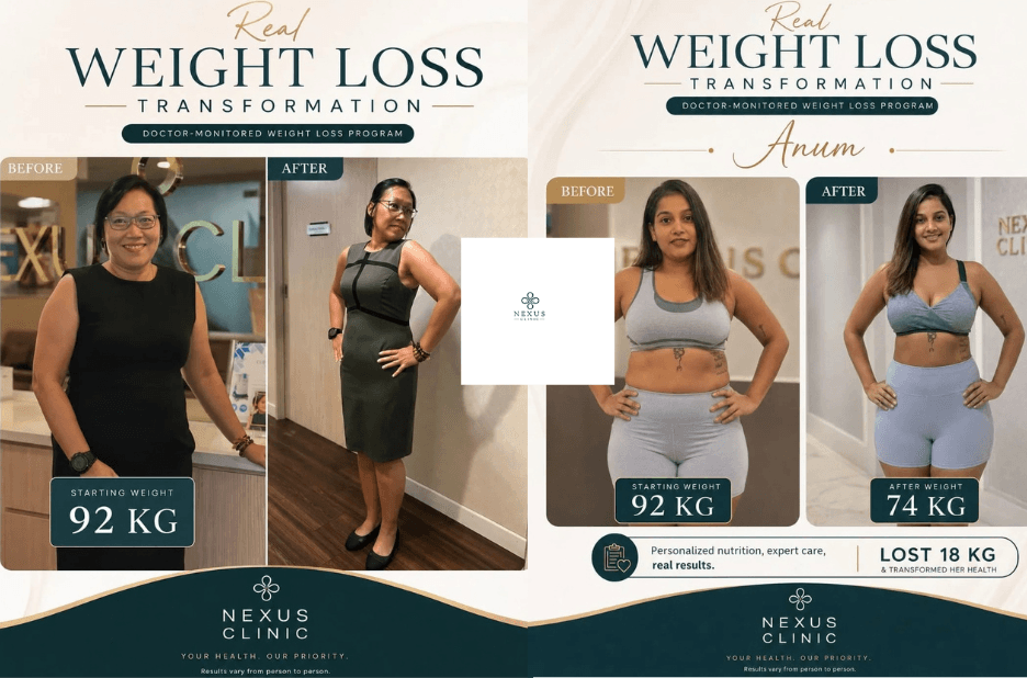 Expert Guidance for Botox in Malaysia at Nexus Clinic
