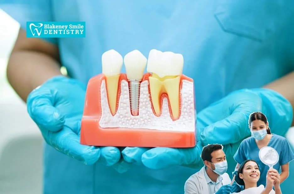 Achieve a Perfect Smile with Invisalign in Charlotte NC at Blakeney Smile Dentistry
